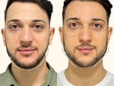 revisado (Post para Instagram (45)) (14) (1)