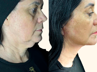 revisado (Post para Instagram (45)) (14) (7)