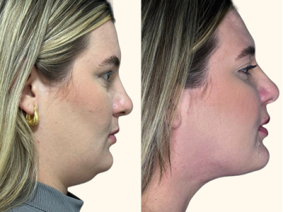 revisado (Post para Instagram (45)) (15) (4)