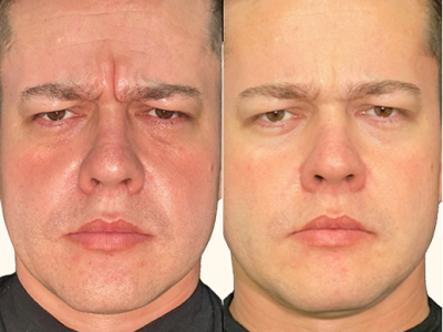 revisado (Post para Instagram (45)) (15) (5)