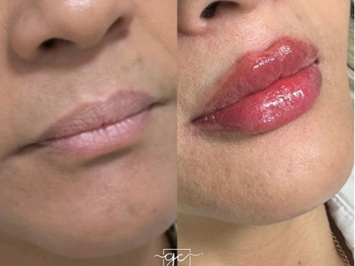 revisado (Post para Instagram (45)) (15) (6)