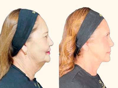 revisado (Post para Instagram (45)) (15) (7)