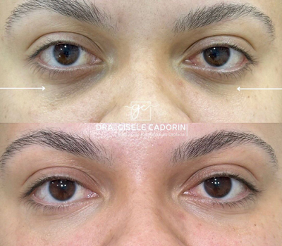 revisado (Post para Instagram (45)) (15) (7)