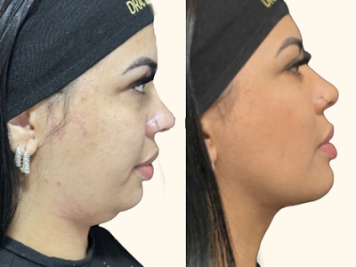 revisado (Post para Instagram (45)) (16) (1)