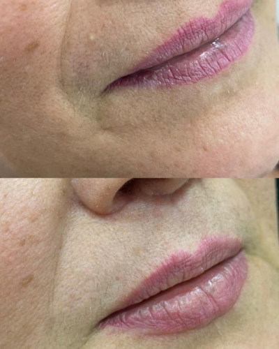 revisado (Post para Instagram (45)) (16) (2)