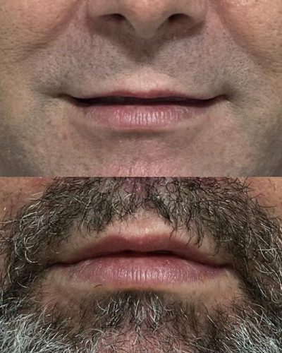 revisado (Post para Instagram (45)) (16) (3)