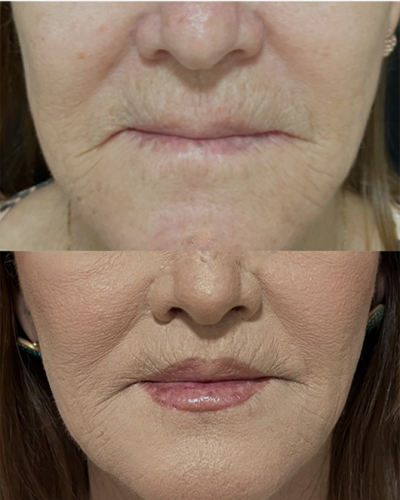 revisado (Post para Instagram (45)) (16) (4)