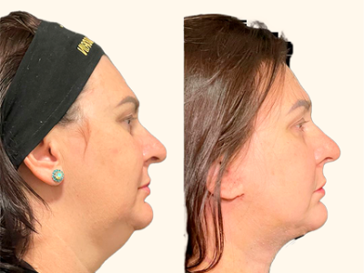 revisado (Post para Instagram (45)) (16) (6)