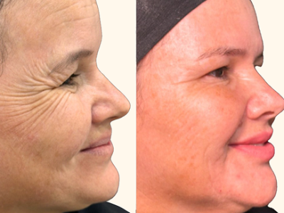 revisado (Post para Instagram (45)) (16) (8)