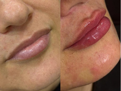 revisado (Post para Instagram (45)) (16) (9)